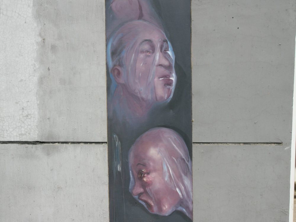 Dysphasia Series
